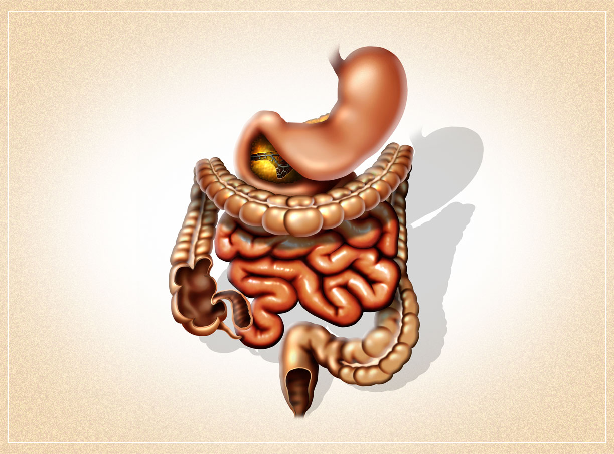 icd-10-coding-tip-crohn-s-disease-aapc-knowledge-center