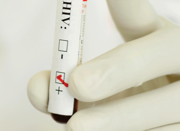 June 27th is National HIV Testing Day: Coding Fundamentals for HIV Screening