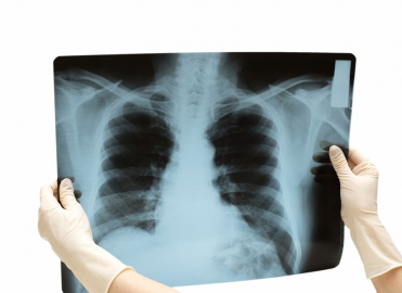 Examine Integumentary and Musculoskeletal Coding Changes Examine Integumentary and Musculoskeletal Coding Changes
