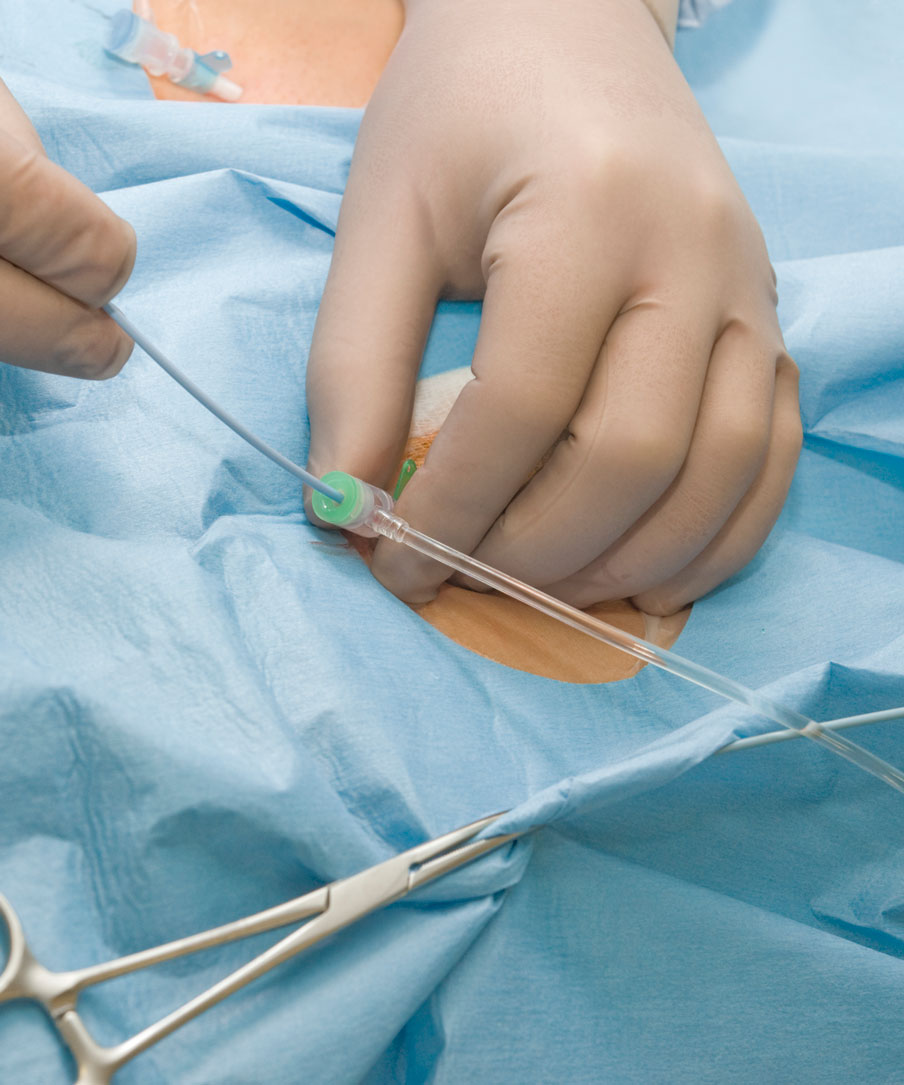 Dissecting Diagnostic Cardiac Catheterization Reports AAPC Knowledge 