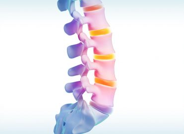 Code Spinal instrumentation in 4 steps