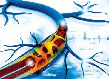 Get Pumped for CPT 2017 Cardiology Updates Get Pumped for CPT 2017 Cardiology Updates
