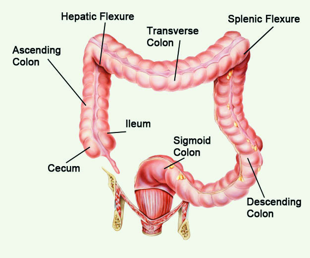 rectosigmoid polyp icd 10