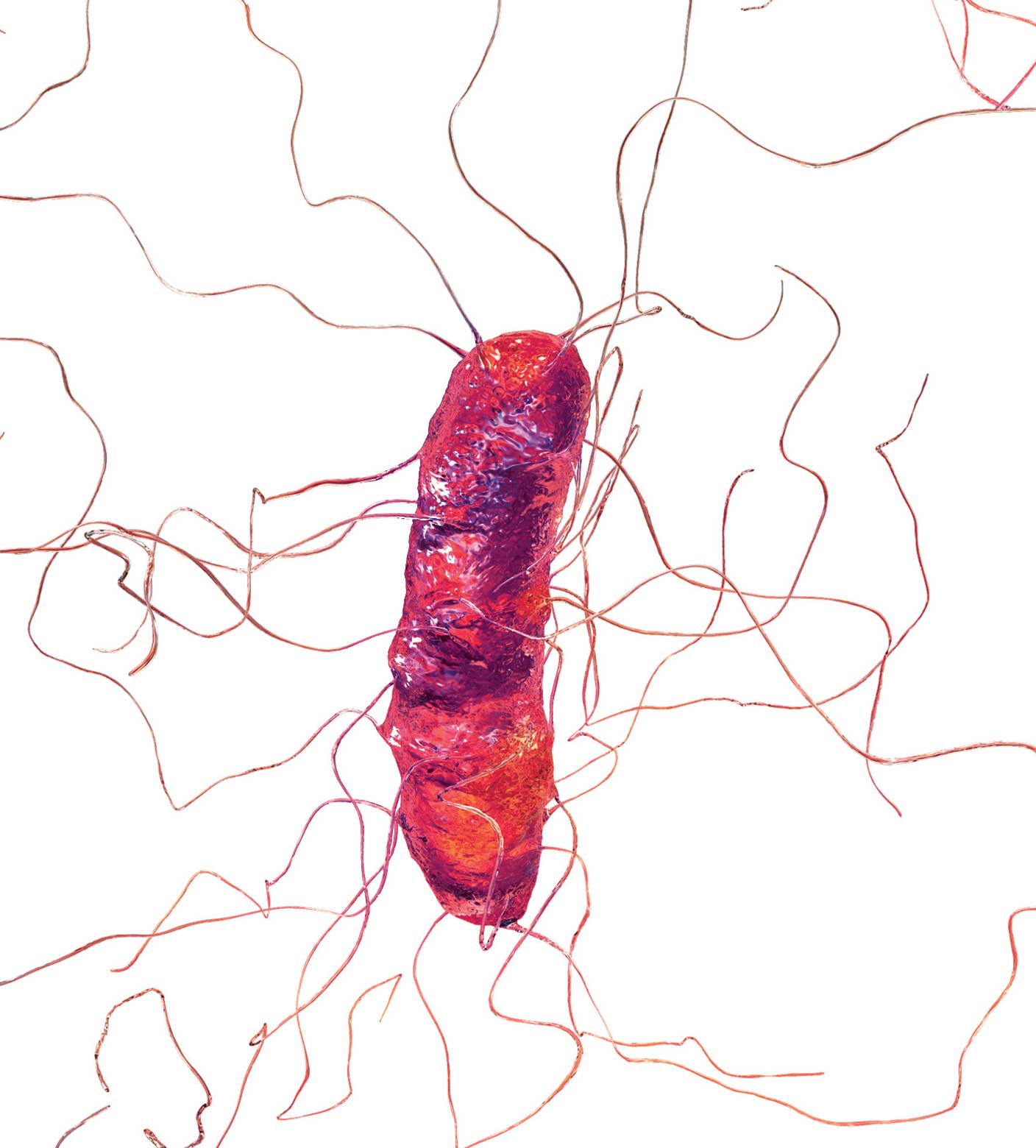 New Classification For Clostridium Difficile Infection In 2018 Aapc Knowledge Center 1607