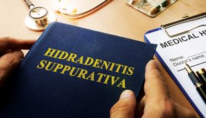 Hidradenitis suppurativa