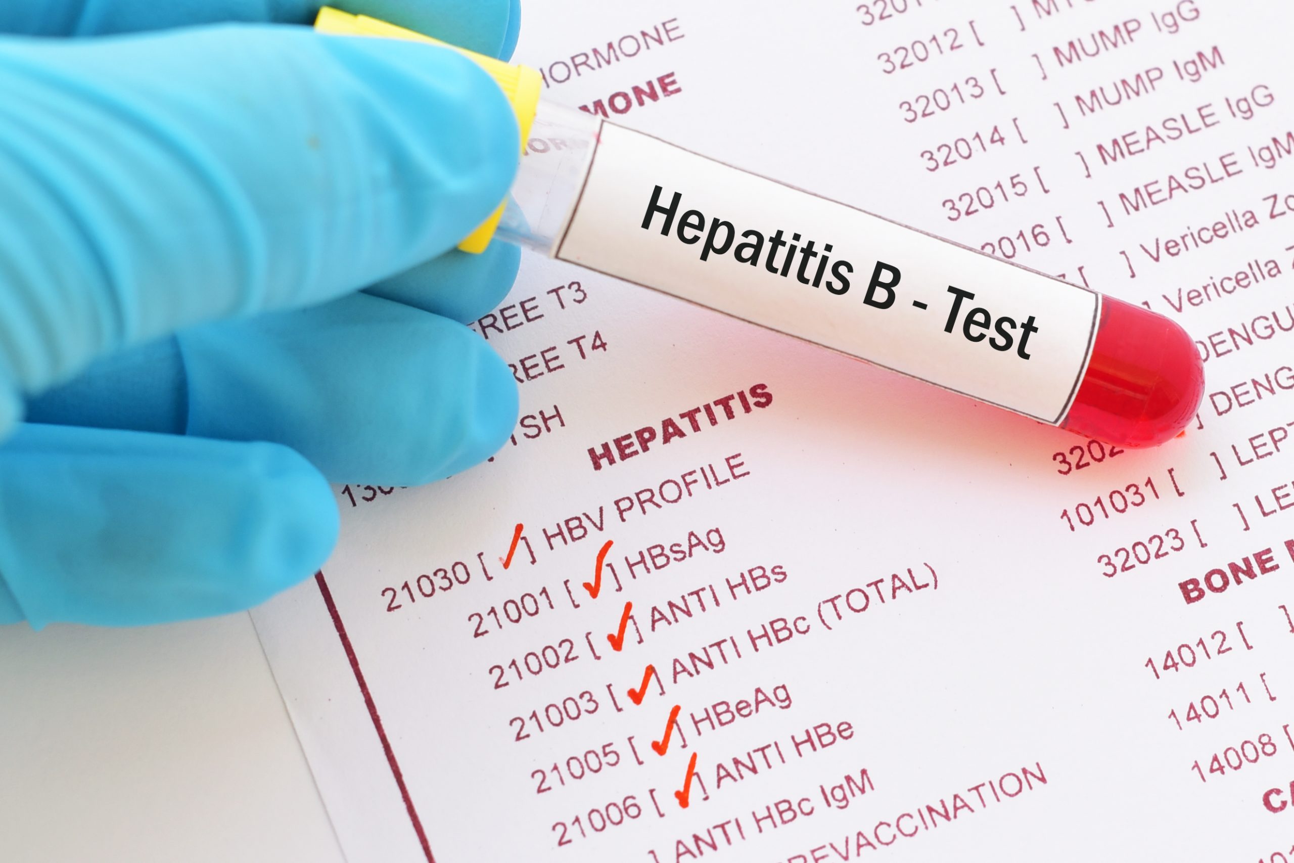 What Is Hbv Screening