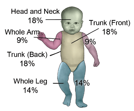 Consider Depth and Other Factors when Coding for Burns - AAPC Knowledge ...