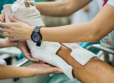 Get a Global Perspective on Orthopedic Fracture Care Coding Get a Global Perspective on Orthopedic Fracture Care Coding