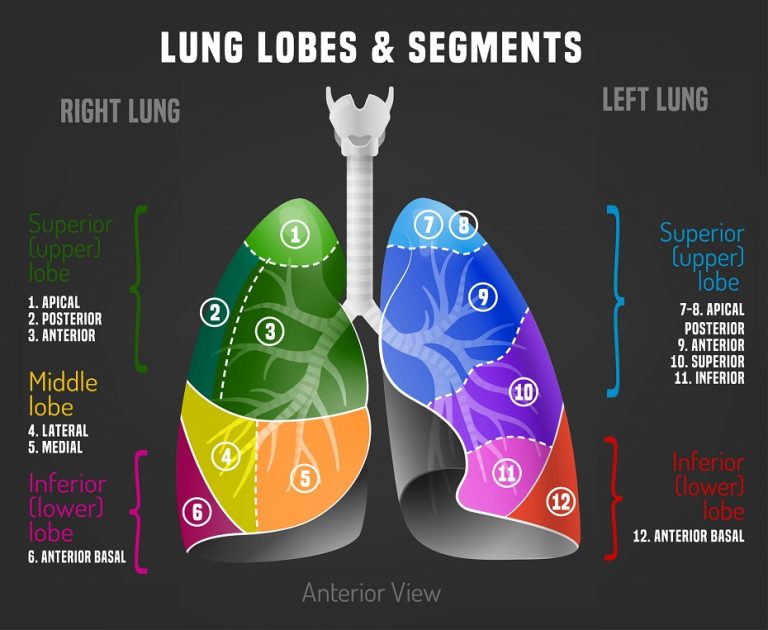 What Is Lobar Pneumonia Aapc Knowledge Center