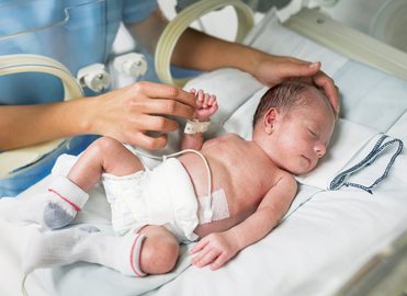 Coding Newborn Attendance at Delivery and Resuscitation