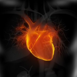 Human heart myocardial infarction.