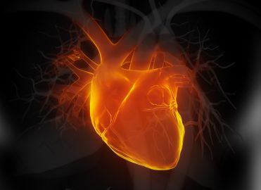 Look for Clues When Coding Myocardial Infarction Interventions Look for Clues When Coding Myocardial Infarction Interventions