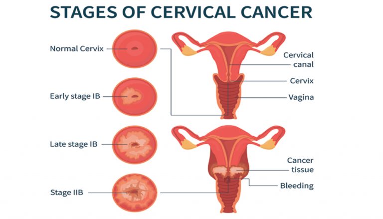 Make Cervical Health a Priority - AAPC Knowledge Center