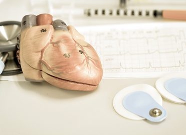 Stress Less Over Coding Cardiac Stress Tests Stress Less Over Coding Cardiac Stress Tests