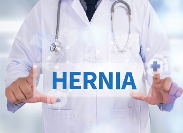 Recurrent Inguinal Hernia Recurrent Inguinal Hernia