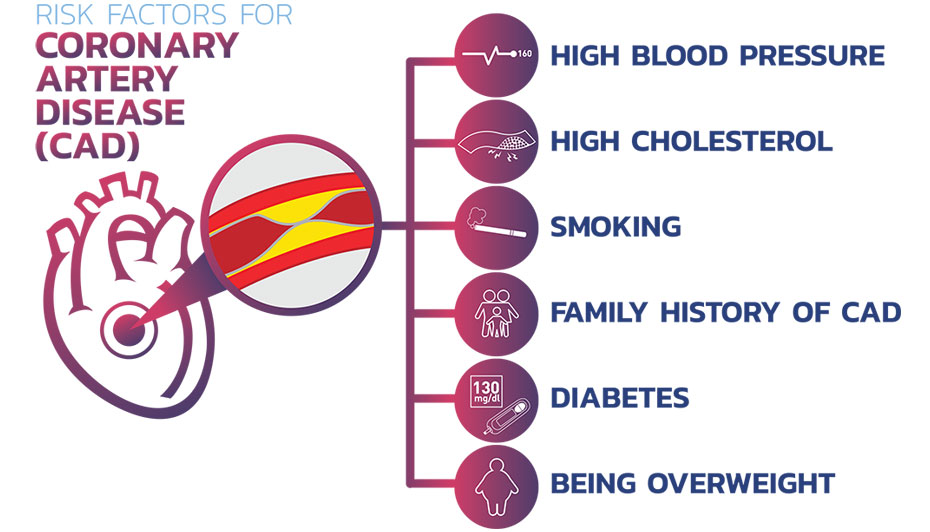 50 Unveiled Facts Intriguing History of CAD ICD 10 Ultimate Guide 2024