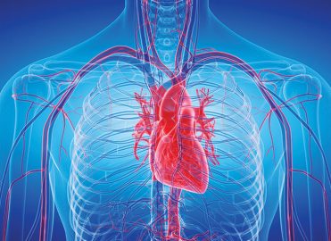 Coding Complex Vascular Cases Coding Complex Vascular Cases