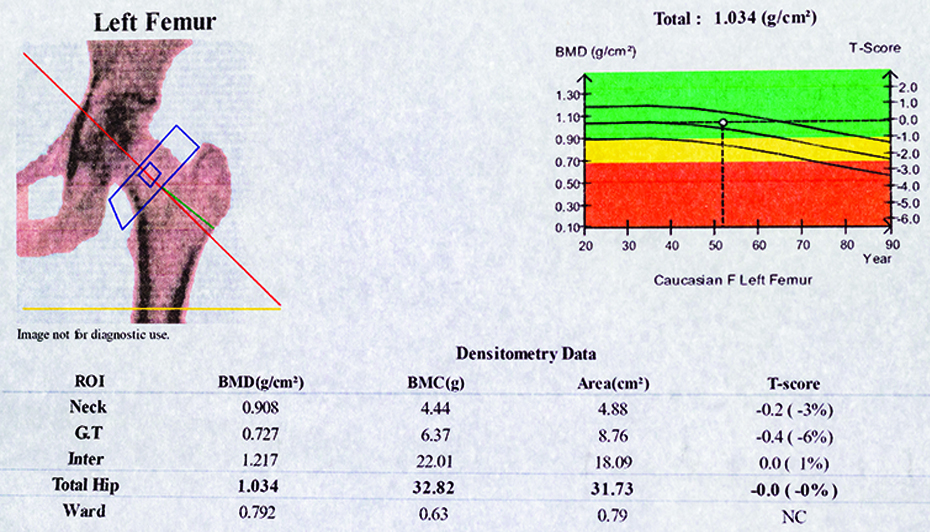 Dexa Scan Score Chart