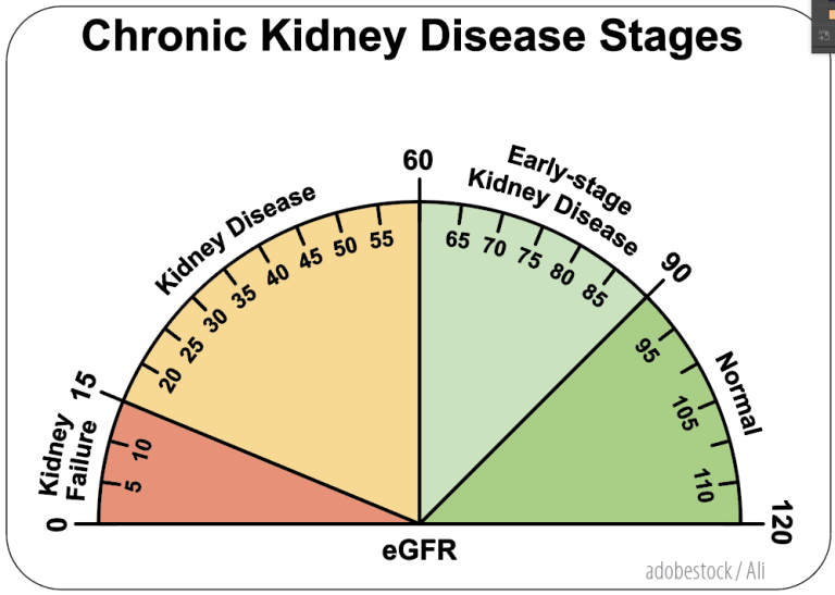 The Risky Business of Coding CKD and ESRD - AAPC Knowledge Center